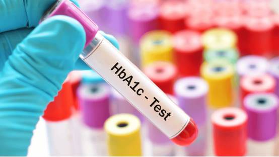 Qu'est-ce que le test d'hémoglobine glyquée (HbA1c) ?