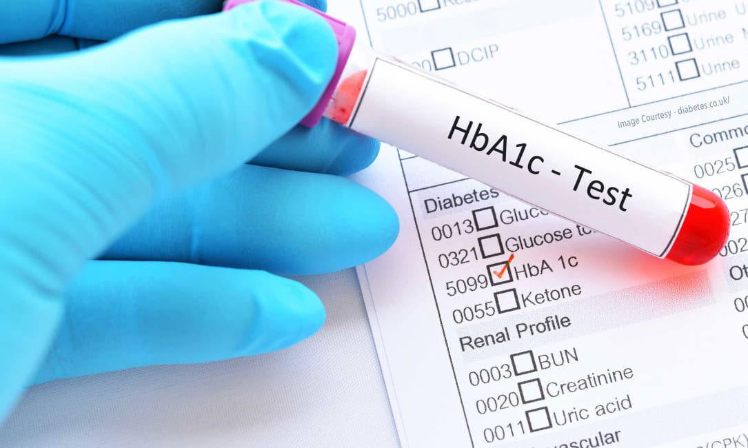 Test HbA1c pour différentes populations